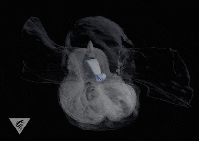 出道即巅峰，越长越退化的动物，教给科学家一绝招，解决海洋污染
