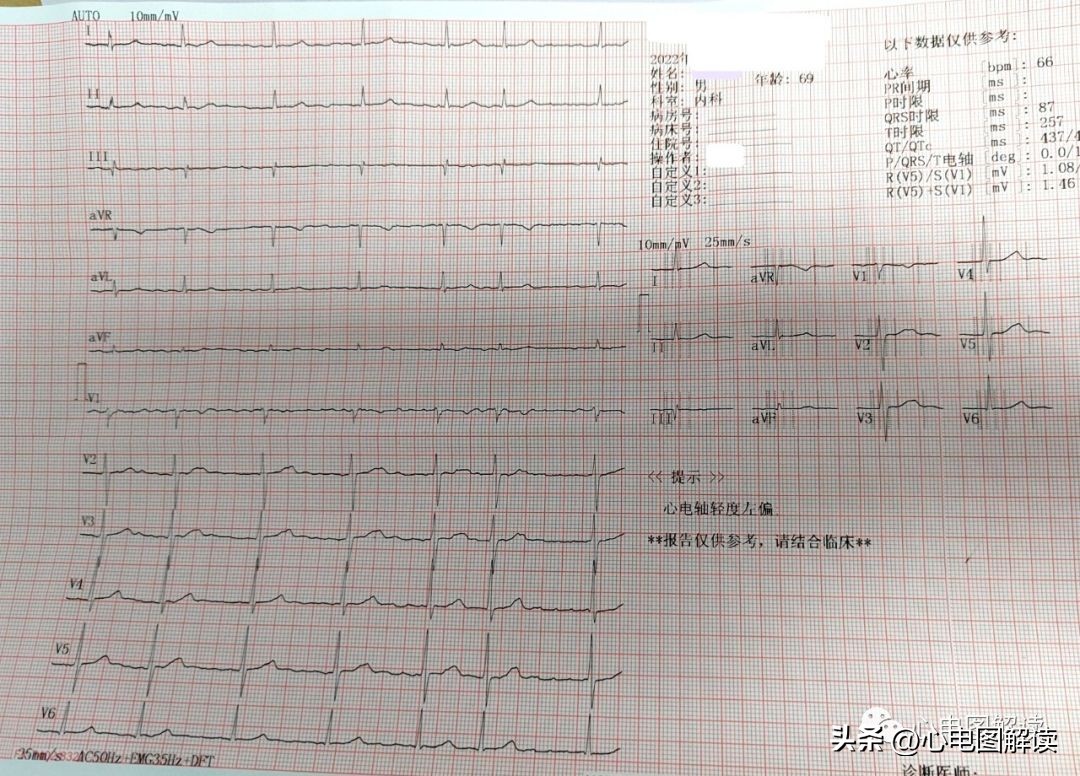 灏忓効蹇冩埧棰ゅ姩,蹇冩埧棰ゅ姩璇句欢