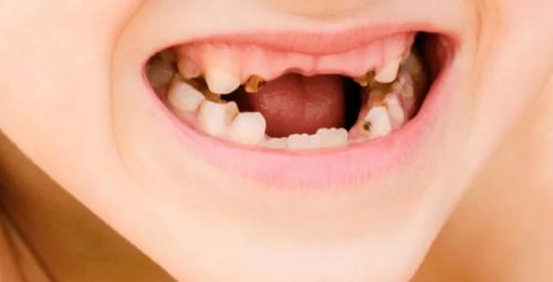 儿童电动牙刷推荐测评最全,便宜又好用的儿童电动牙刷测评