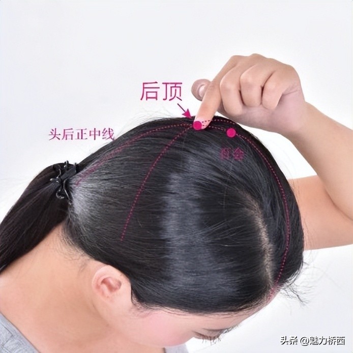 阳康之后头痛怎么办,阳康之后一直头疼是怎么回事