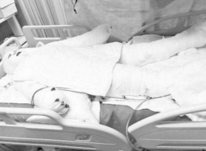 切肤之爱真实上演，河北妈妈割皮救子，就算割光全身的皮也不怕