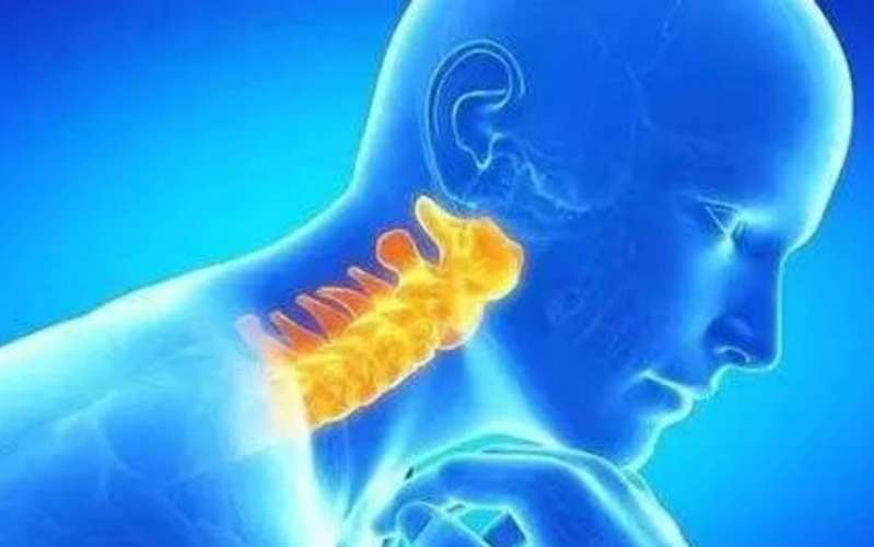 刺络拔罐联合常规针刺治疗神经根型颈椎病如何治疗?疗效如何?