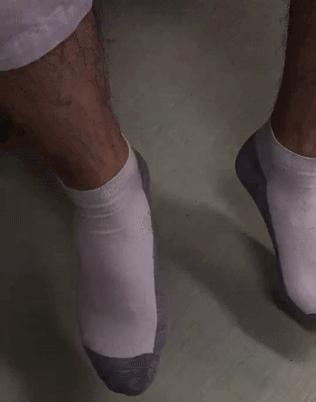 足内翻容易崴脚,足内翻多走路锻炼能减轻吗