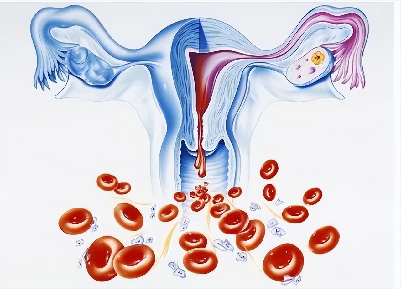 女生来例假时流出了血块,女性来月经有血块怎么回事