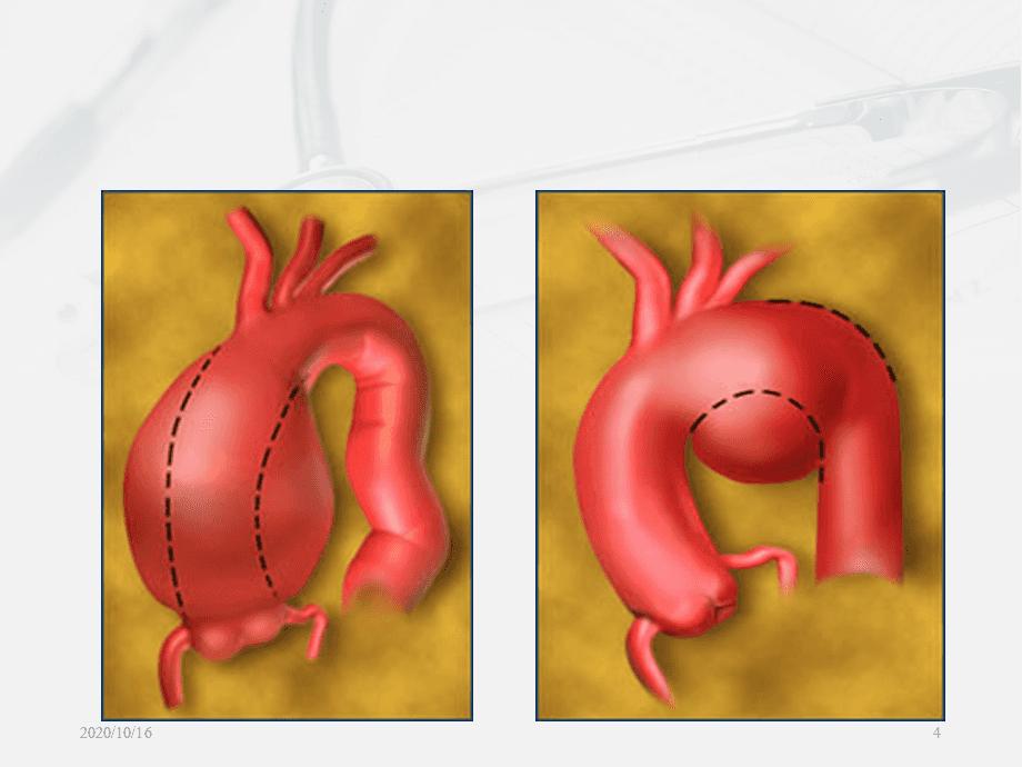 2021年，菲律宾空姐与十一名男性狂欢后离奇死亡，真相到底是什么