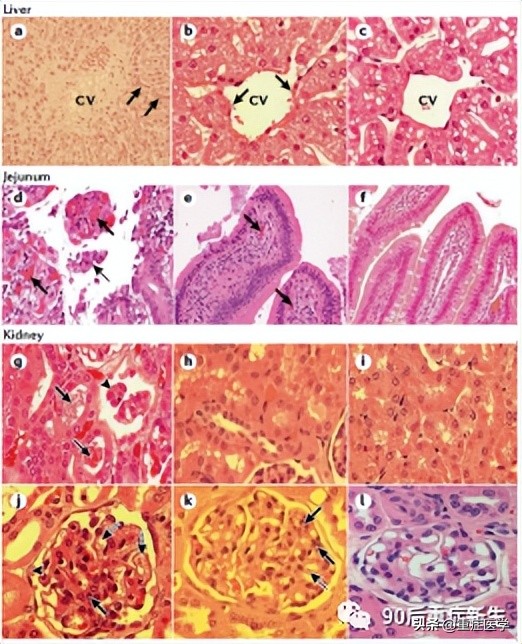 简述重症中暑三种类型的区别,中暑类型有哪三种类型