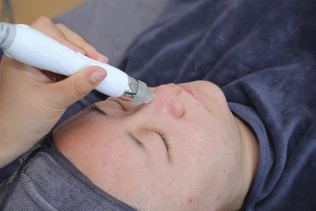 小气泡功能越多越好吗,小气泡水氧焕肤组合的效果和功能