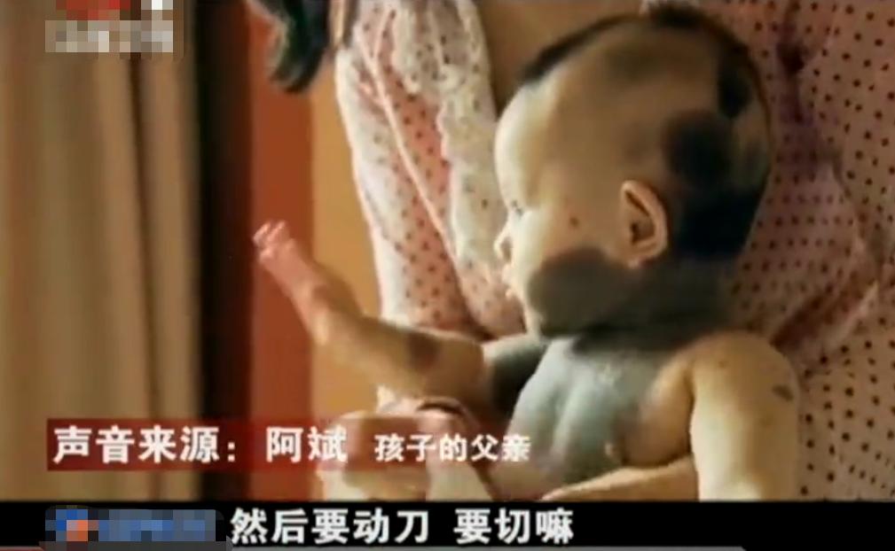 吃竹鼠的熊猫宝宝现在怎么样了,怀孕时吃竹鼠生下奇怪小孩后续