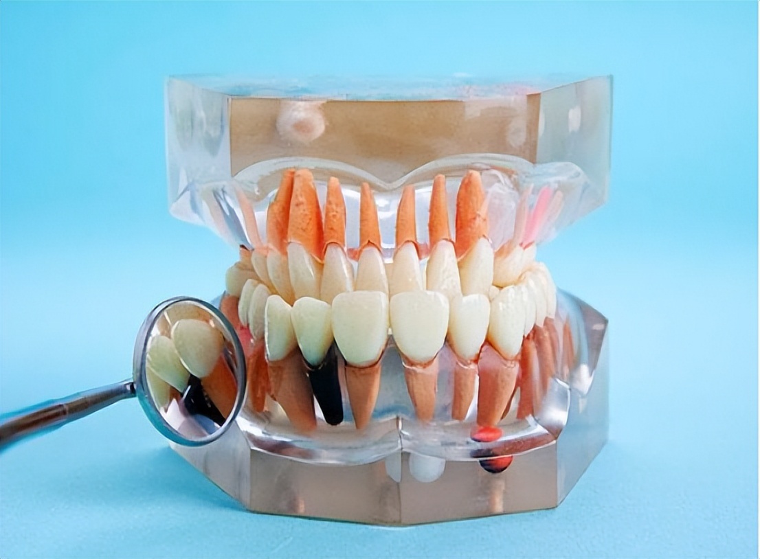 牙龈纤维瘤是肿瘤吗,牙龈纤维瘤会遗传给下一代吗