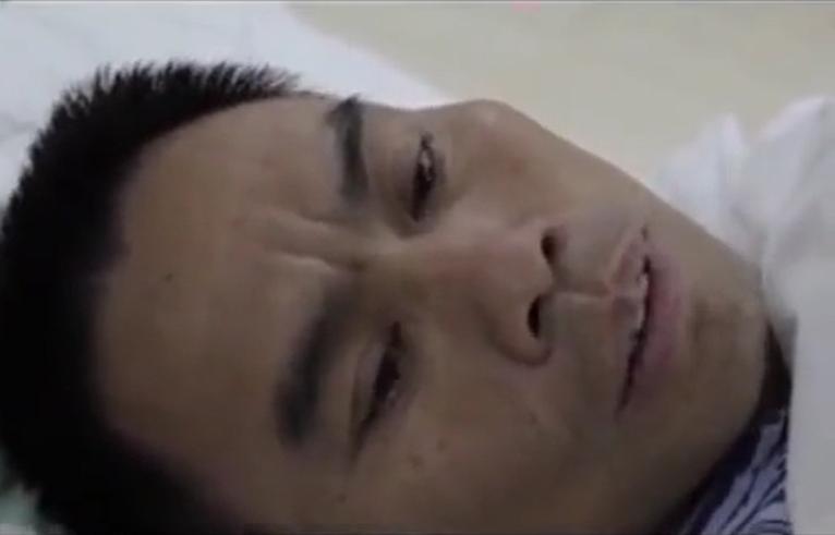 故事：湖北55岁男子病从口入，孕出成千上万虫卵，肚子竟成虫窝