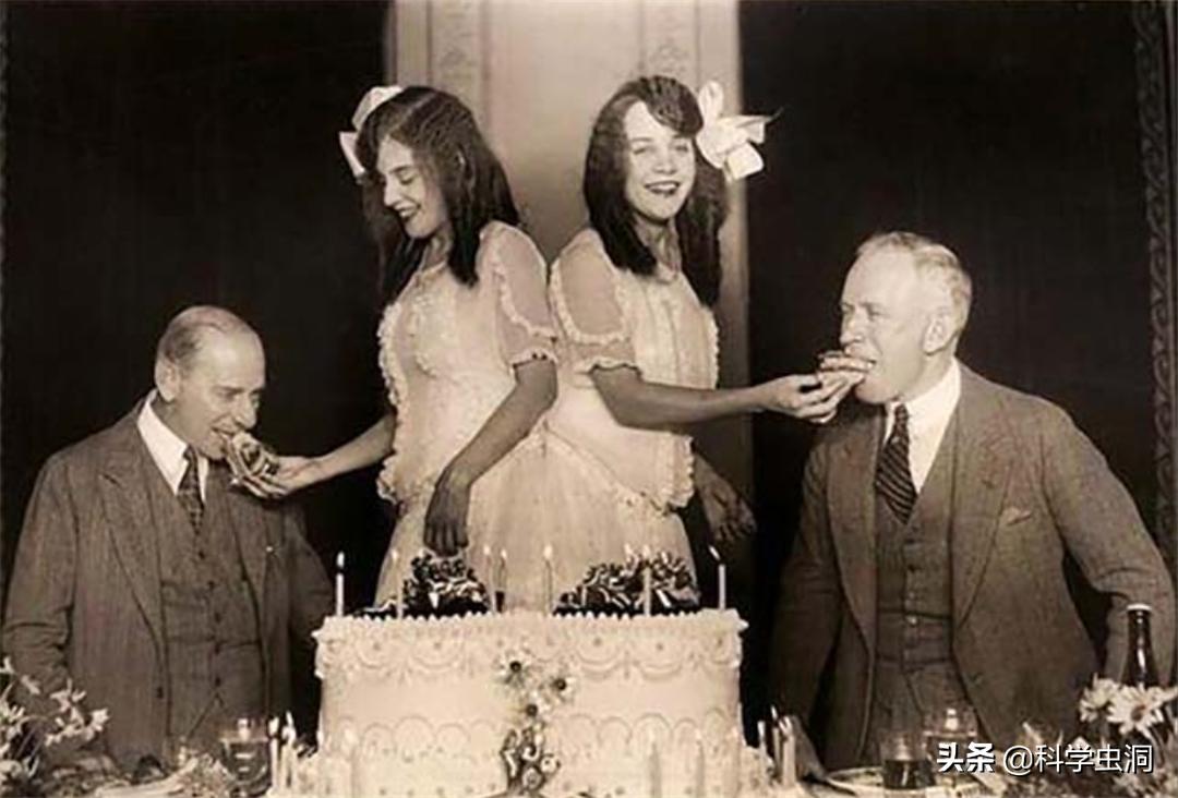 连体姐妹其中一个人死了怎么办,连体姐妹一个死了另一个咋办