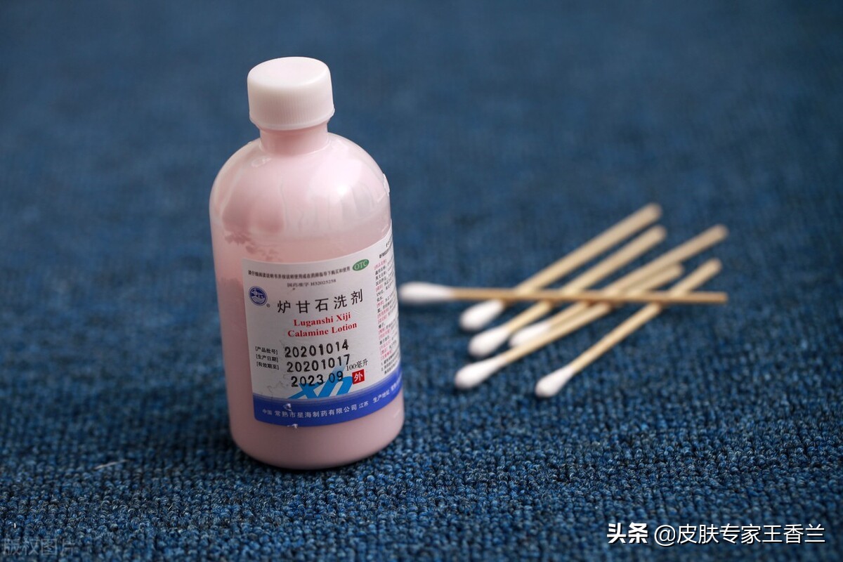 炉甘石洗剂对皮肤瘙痒有效果吗,炉甘石洗剂治疗糖尿病皮肤瘙痒