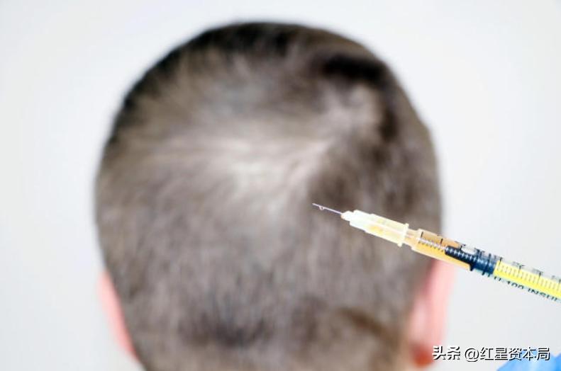 雍禾医疗小知识讲解植发,雍禾植发2023一口价还要开台费吗