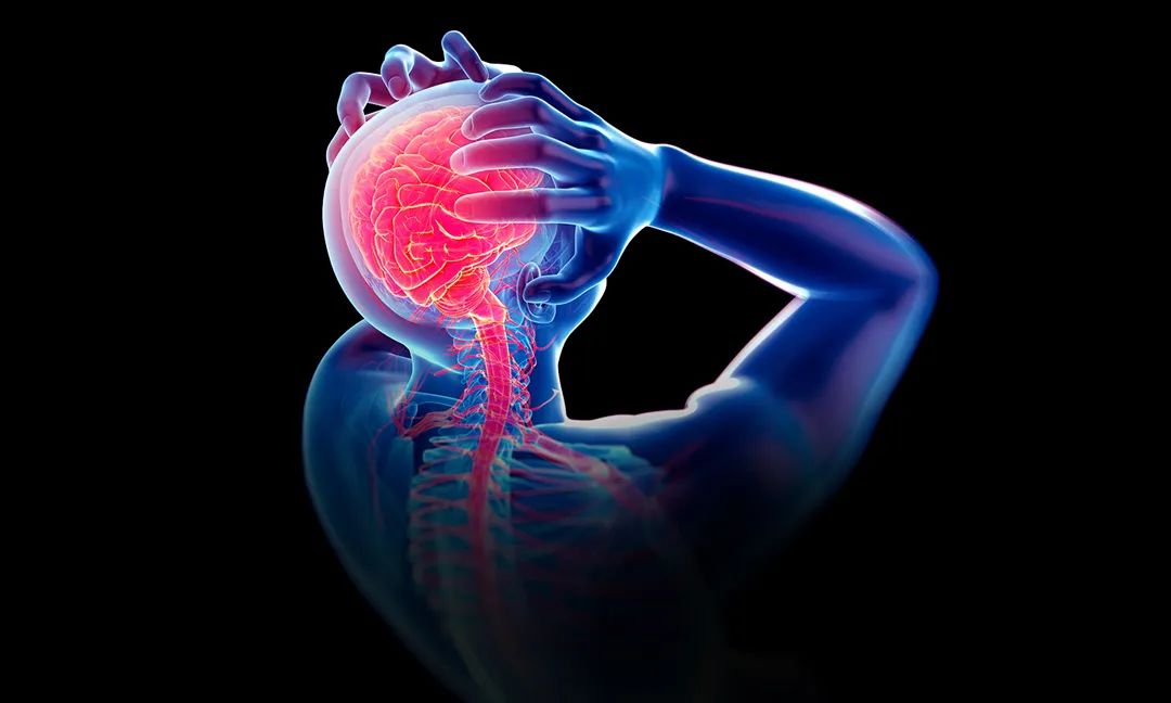 偏头痛最新研究资讯,困扰患者十年的偏头痛一招解决