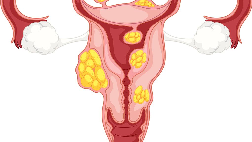 没有子宫的女性，还可以“办事”吗？医生的这些话，希望你听进去