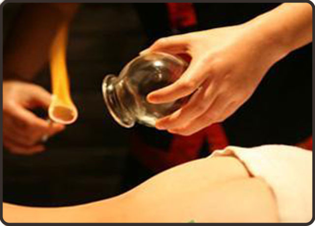 肚脐拔火罐注意事项,拔火罐穴位注意事项