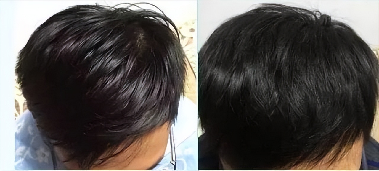 如何洗完头头发蓬蓬松松,洗完头头发干燥怎么办