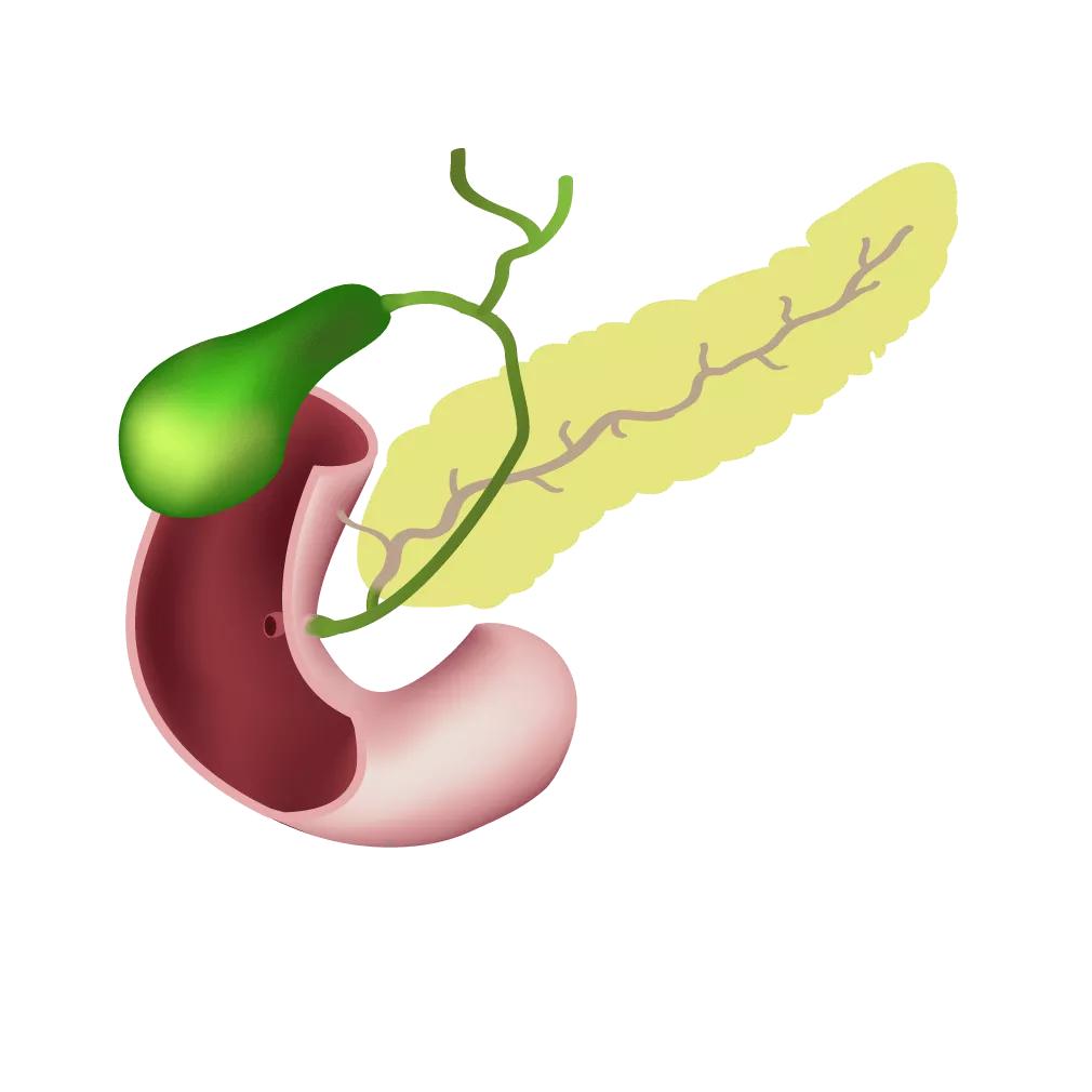 发现肝内胆管结石不治疗会怎样,胆管结石复发率是多少
