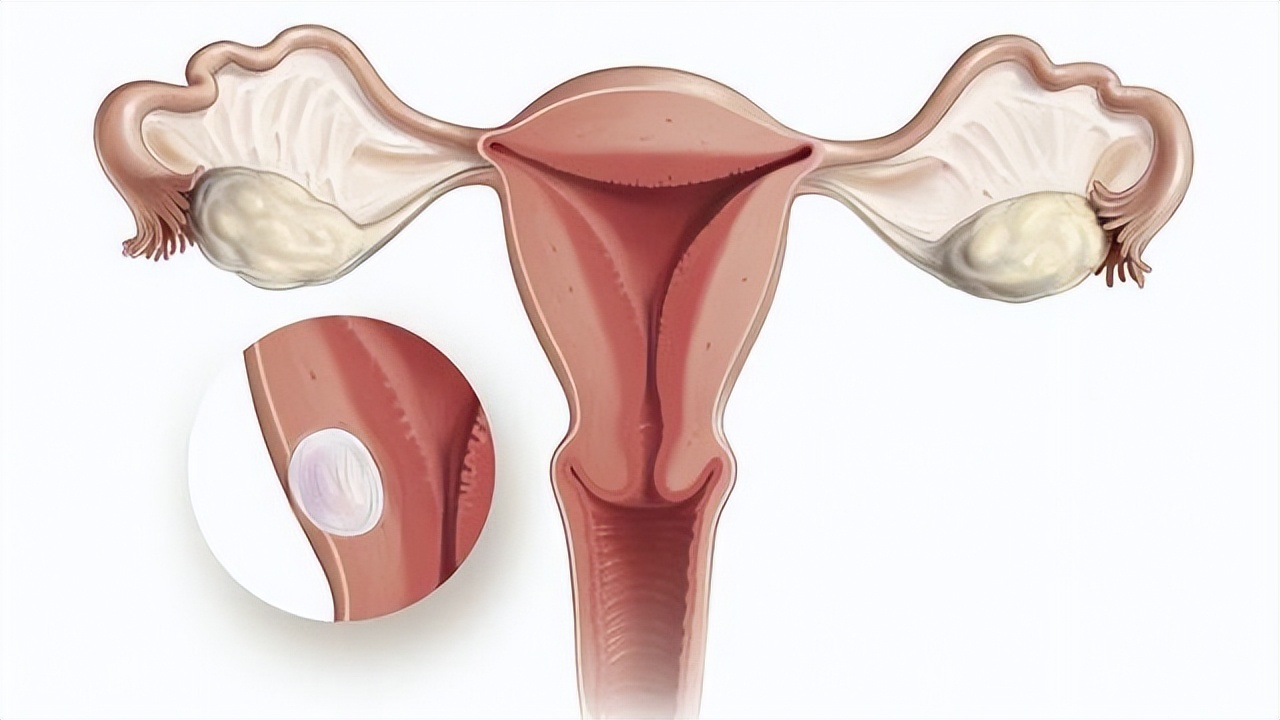 上了年龄子宫能修复吗,年纪大了子宫掉出来了