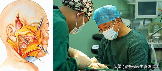 小切口面部提升能维持多久,面部提升的穴位手法完整视频