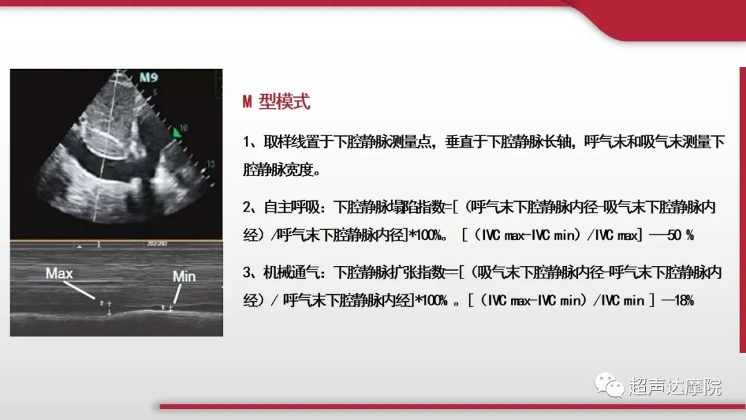超声ppt课件大全,下腔静脉彩超评估容量