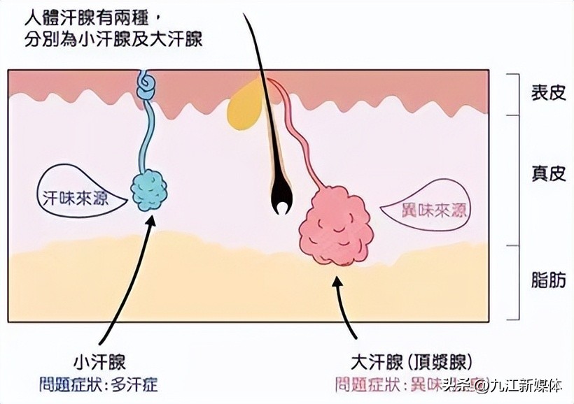 九江市中医院除狐臭多少钱,九江哪家医院做狐臭手术
