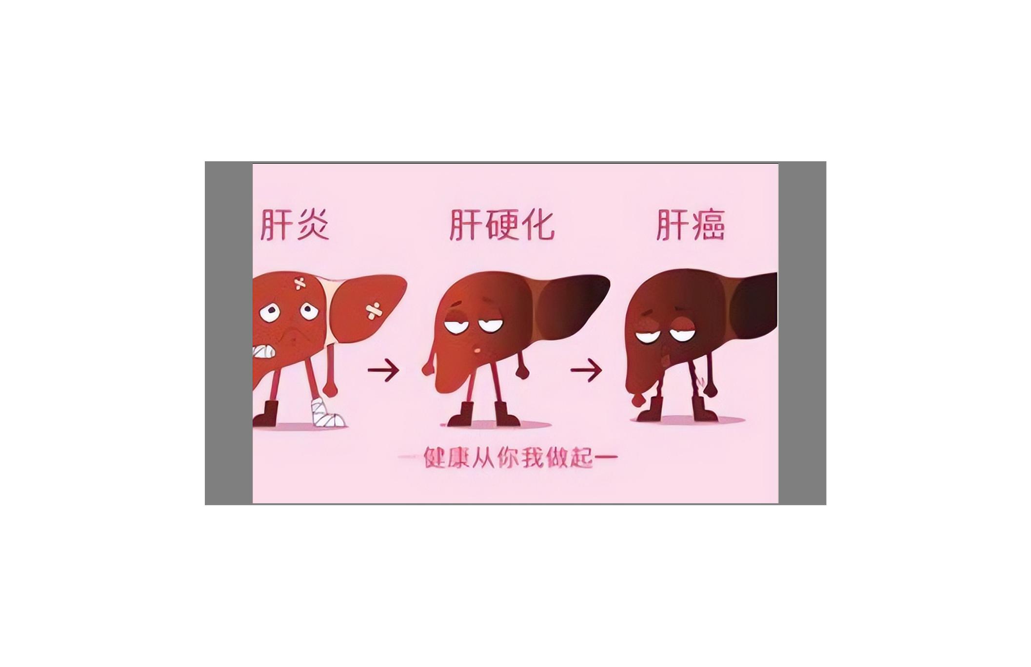 抗病毒治疗可以使甲胎蛋白降低吗,肝癌手术三年后甲胎蛋白升高到40