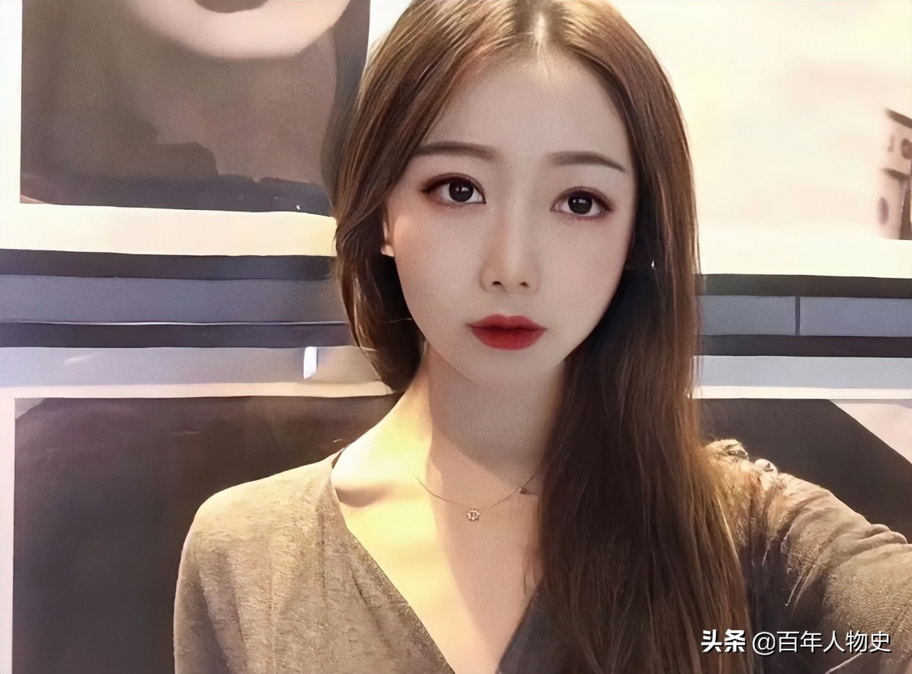 19年,四川20岁女孩遭大火毁容48%烧伤,双臂截肢如今怎么样了?