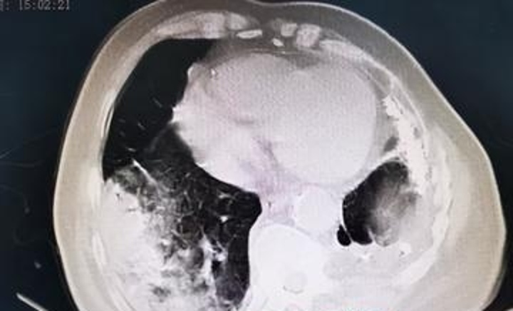 2023年12月11日2点11分,2023年12月11日11点43分