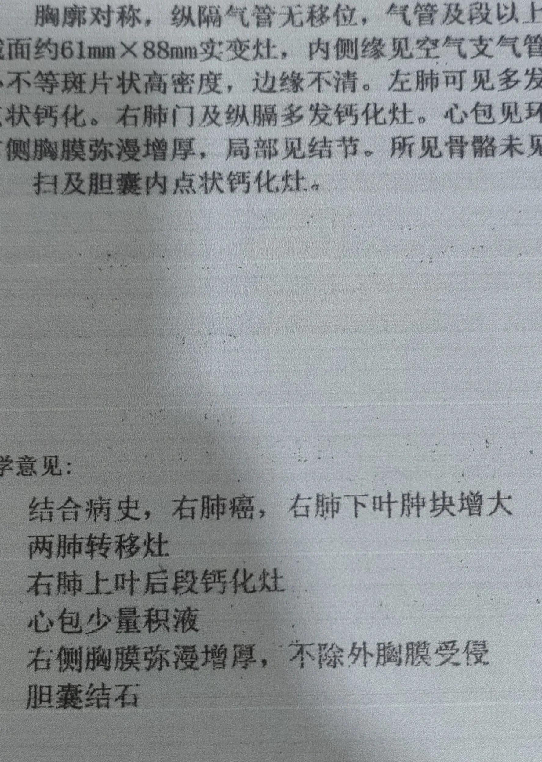 肺癌治愈后肺炎是不是可以自愈,肺炎因病情恶化经抢救无效