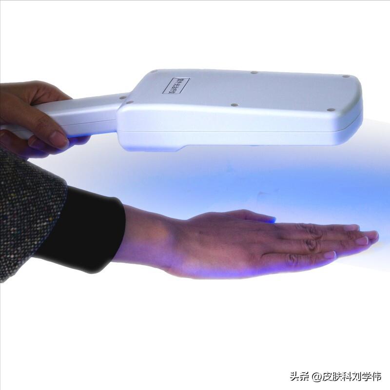 自己在家用白癜风光疗仪,在家治疗白癜风最好的效果