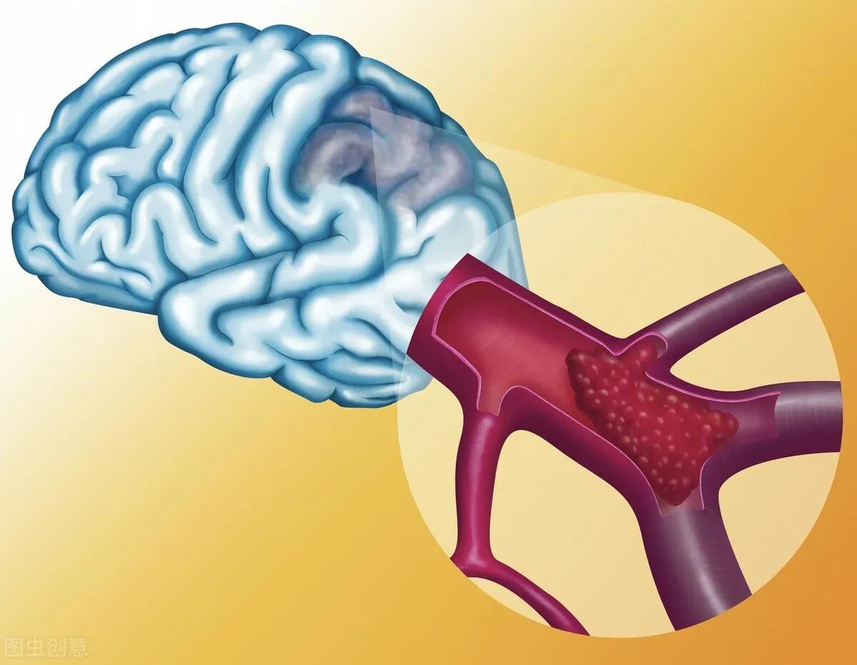 3味中药降血脂扩血管溶血栓,有哪些药可以降甘油三酯血脂