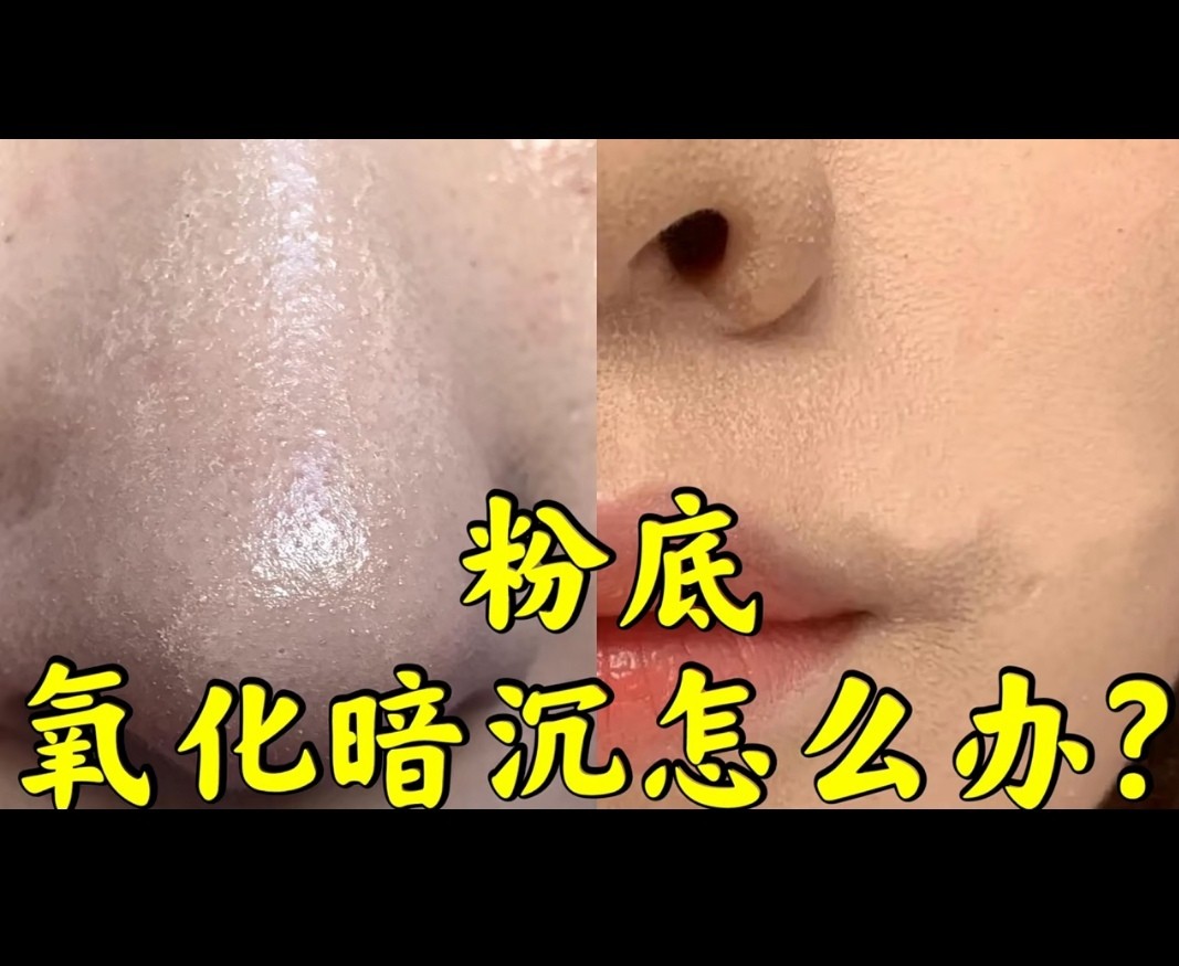 皮肤暗沉发黄用什么粉底液,皮肤暗沉发黄用什么颜色的粉底液