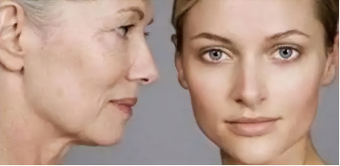 去除老年斑最有效的药膏,用什么药膏治疗老年斑最有效