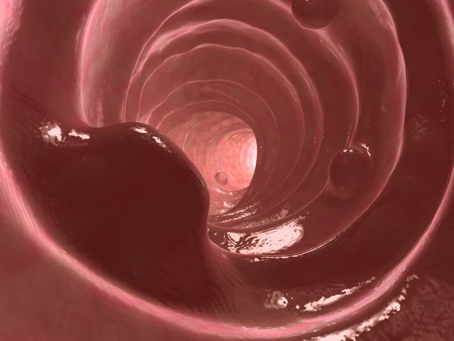 中医治疗肠息肉怎么样,中医肠息肉治疗