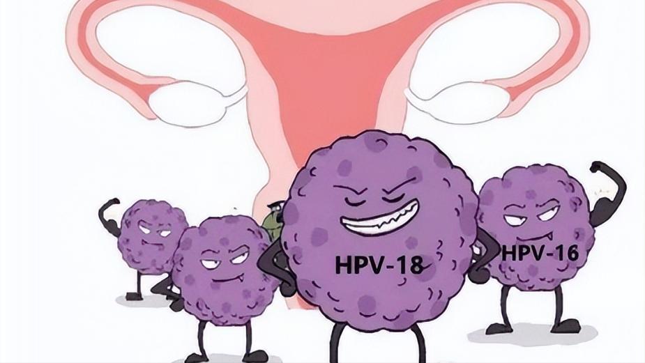 54岁女子确诊外阴癌，追悔莫及！提醒女性：下身4种异常，别大意