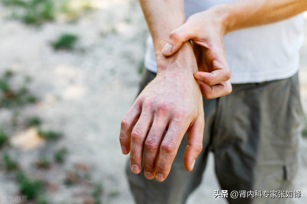 肾衰竭刚开始,肾衰竭的早期精神表现