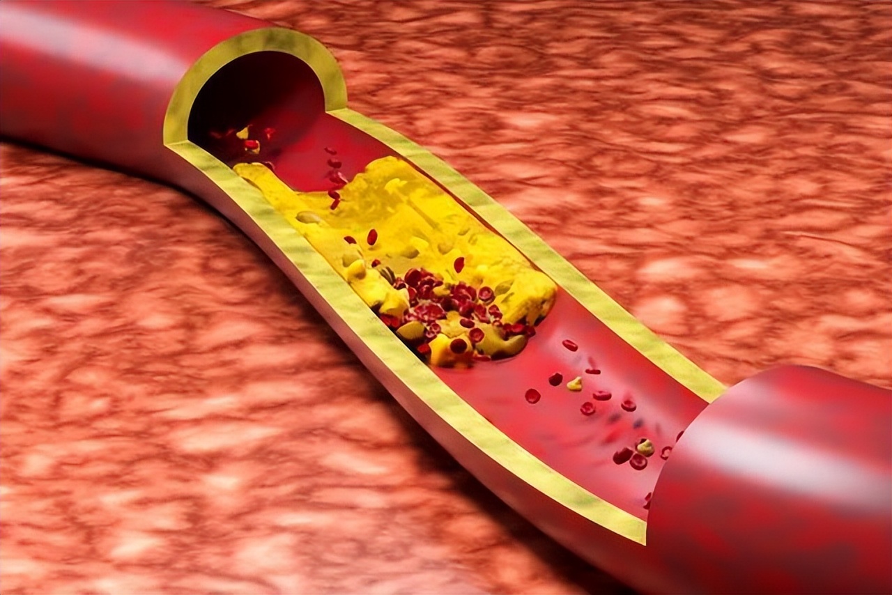 西红柿尽量少吃最好不吃有道理吗,老中医为何建议西红柿尽量少吃