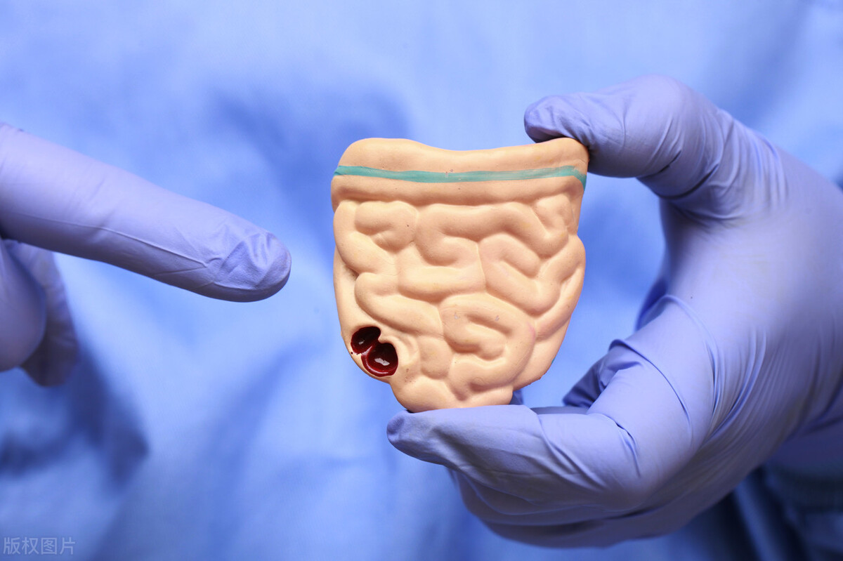 大便后有种排不净感觉是什么情况,老是感觉大便没拉完是什么原因