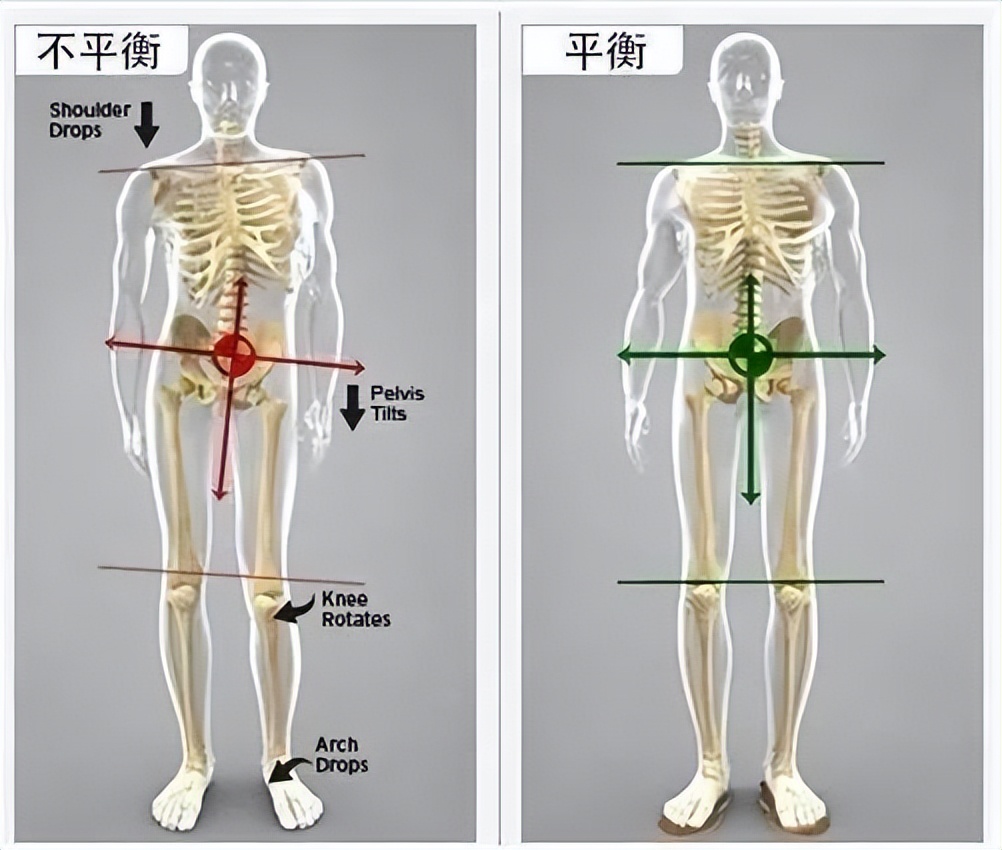 长短腿的原因和解决方法,长短腿引起症状该怎么处理