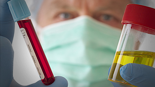 膀胱癌症啥症状影响大便吗,身体有癌小便先知