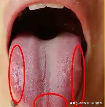 一吃凉的就胃痛食疗方法,吃了凉性食物胃痛怎么缓解