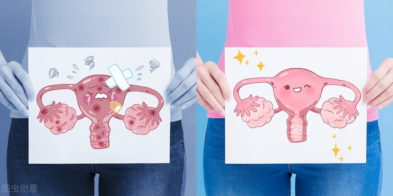 一女子睡觉半夜咳嗽发现子宫脱垂,咳嗽会引起子宫脱垂吗