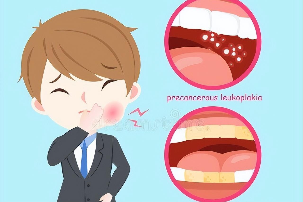 真实的口腔癌案例,口腔癌占癌症的第几位