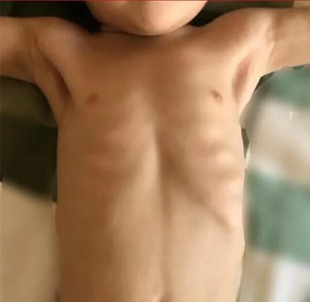 青少年脾胃虚弱瘦怎么调理才有效,小孩脾胃不好偏瘦怎么调理