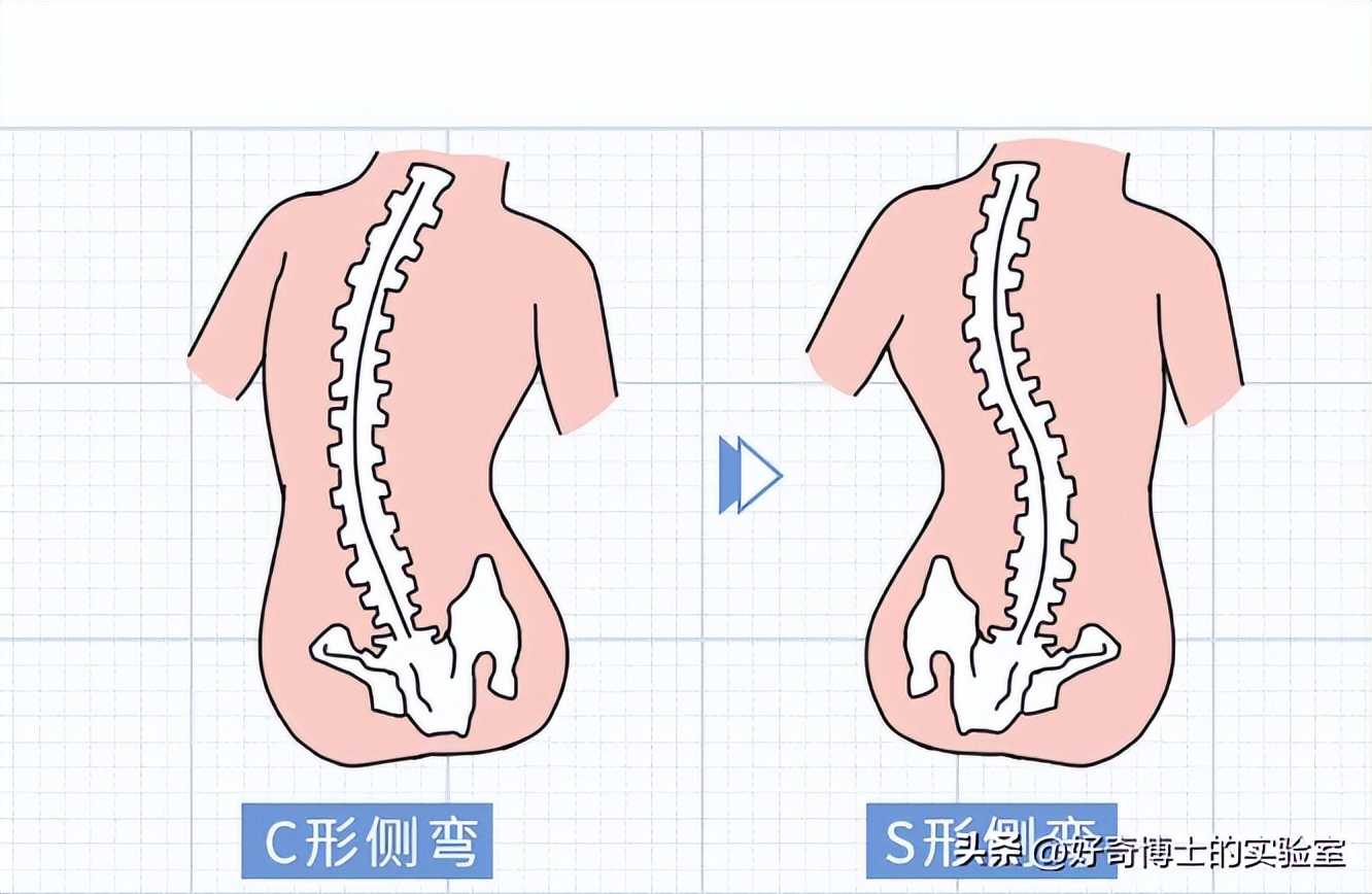 什么姿势能把腰掰响,哪些姿势对腰不好