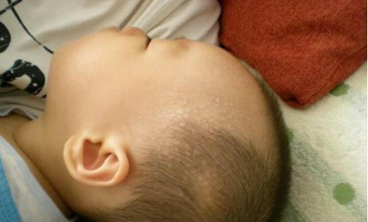 娃一到晚上就发烧出汗,娃一睡觉就出汗怎么回事