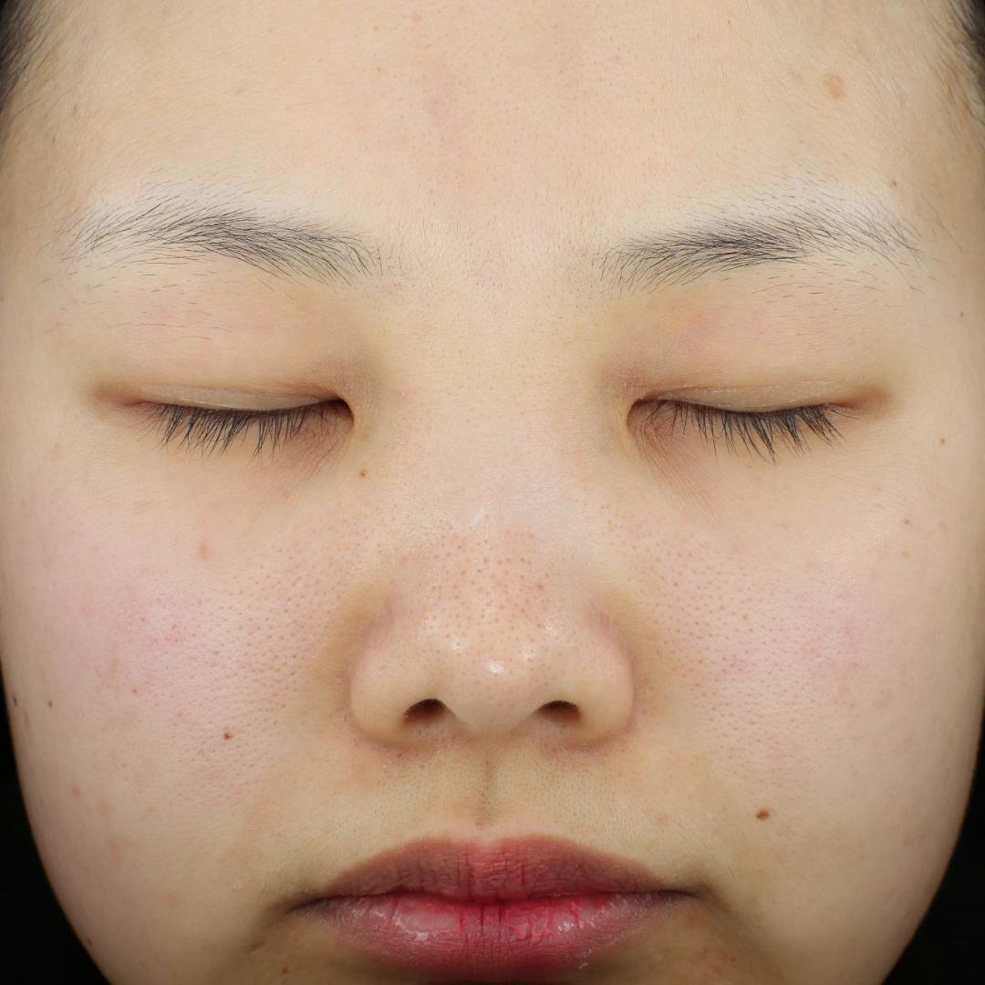 美容仪多人测试,美容仪人体测试