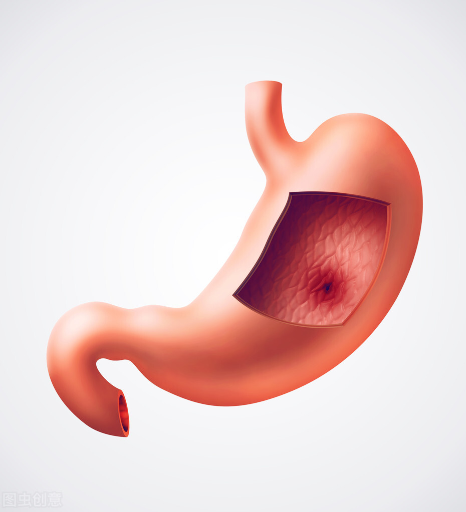 塞来昔布胶囊可以治疗膝关节炎吗,塞来昔布怎么对关节炎消炎的