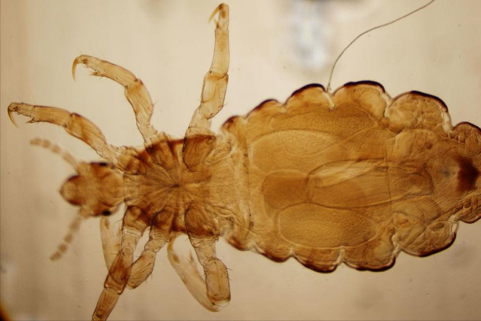 安全套“套”上就完事？这4个错误做法，不少男性还没意识到